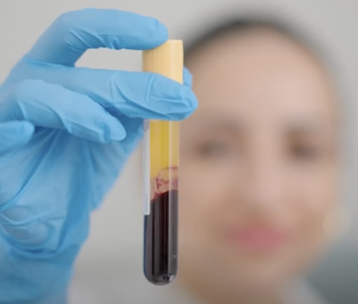 We Now Offer Blood Tests at Este! Este Medical Group